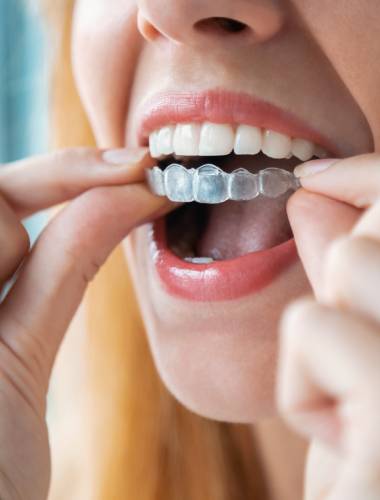 Someone using Invisalign retainers