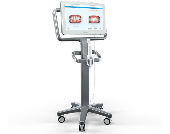 An illustration of an iTero scanner – A type of intraoral scanner