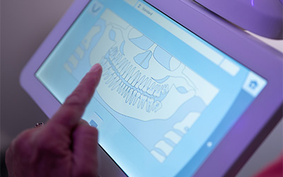 dental scan