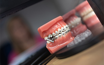 teeth