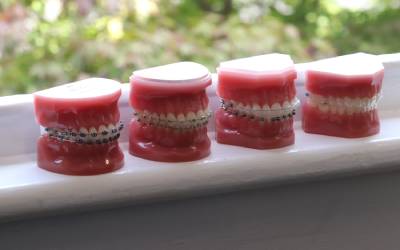 typodont model teeth on a windowsill